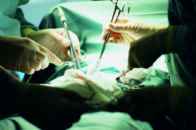 хируршко зголемување на дебелината на пенисот